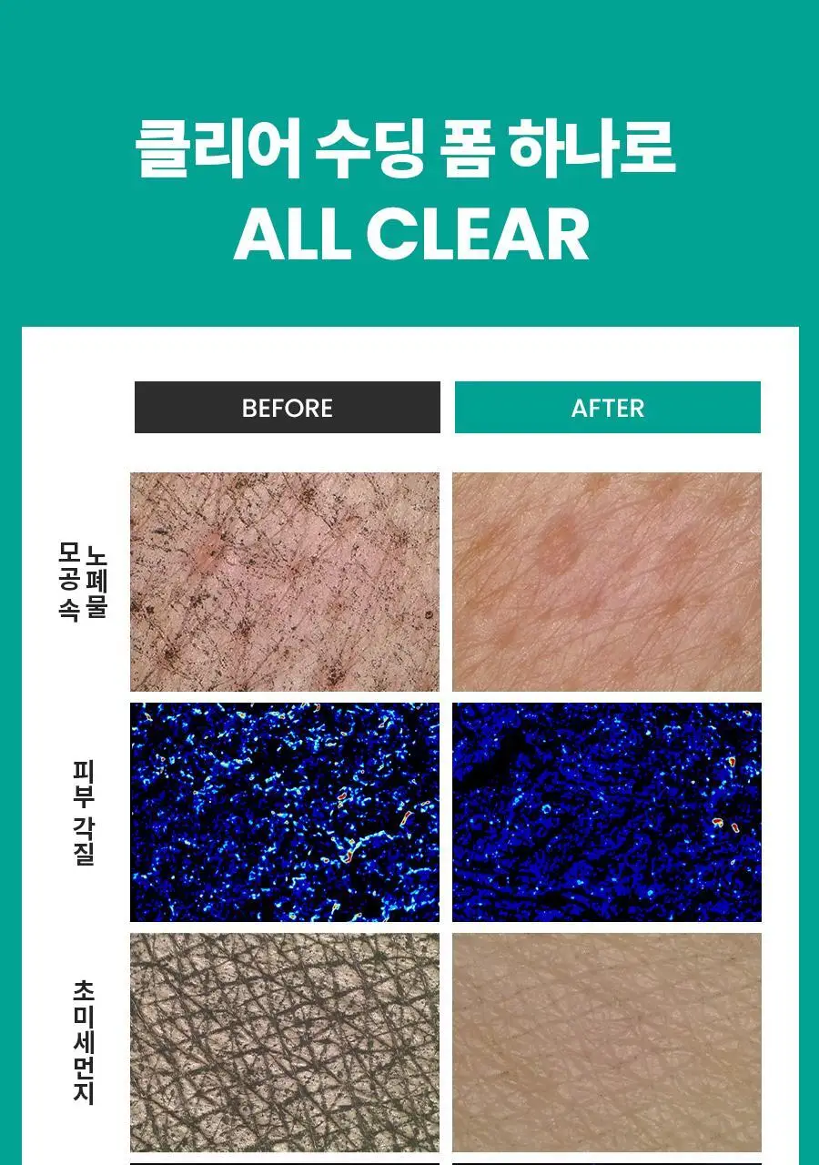 [증정/약산성] 닥터지 약산성 레드 블레미쉬 클리어 수딩 폼 기획2종 택 1(150ml+75ml/150ml+150ml) 상세페이지 12